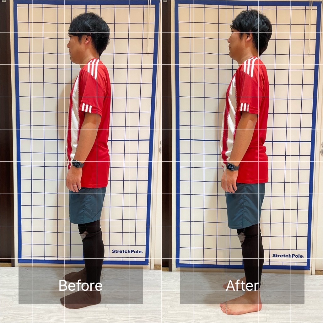 姿勢変化ビフォーアフター③