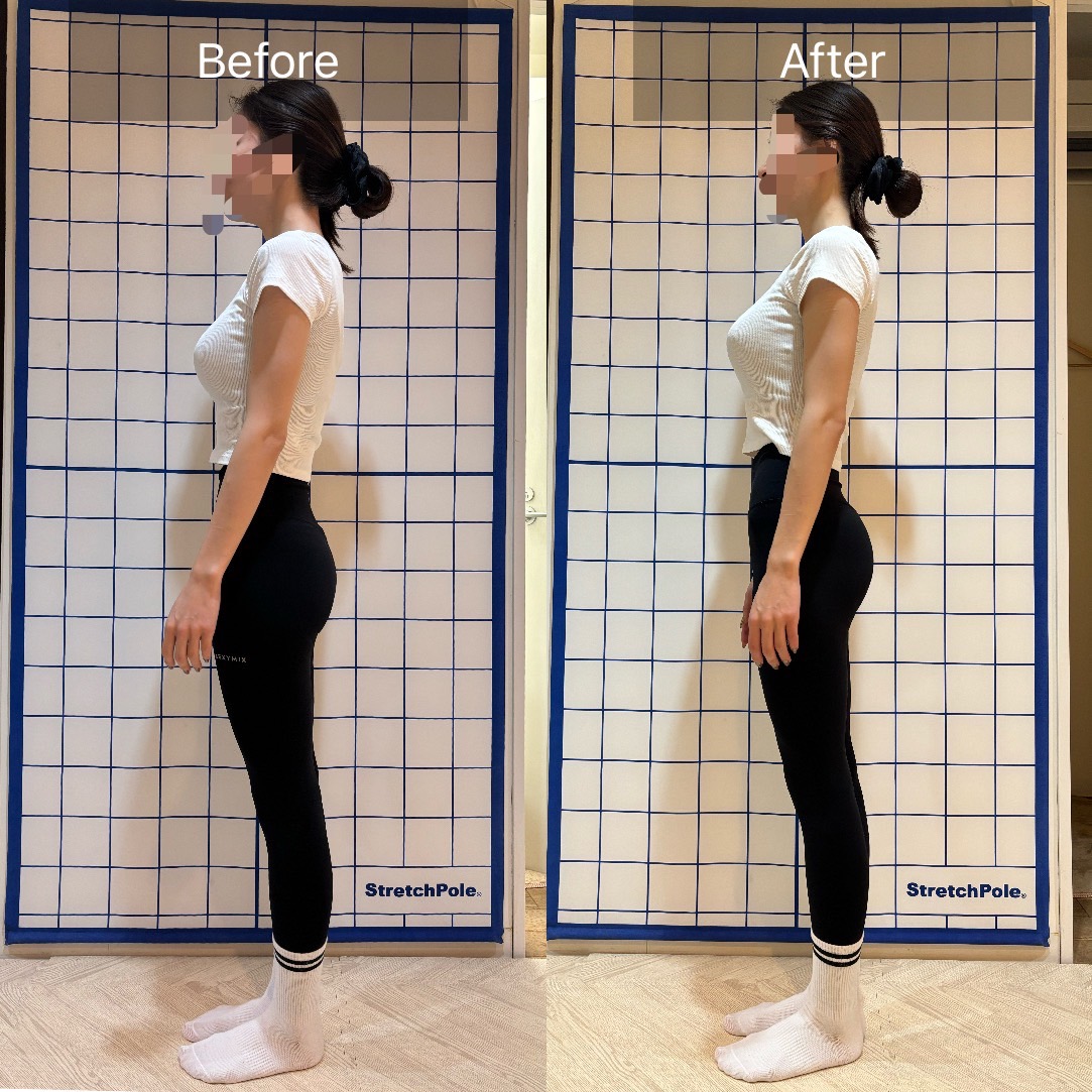 姿勢変化ビフォーアフター④